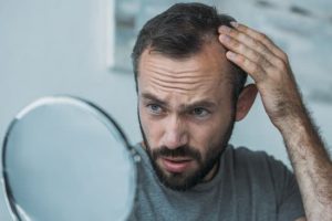 年代別の抜け毛の要因